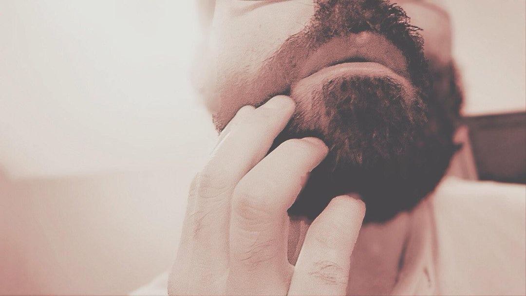 5 Common Beard Problems + How to Solve Them - Kingsmen Premium