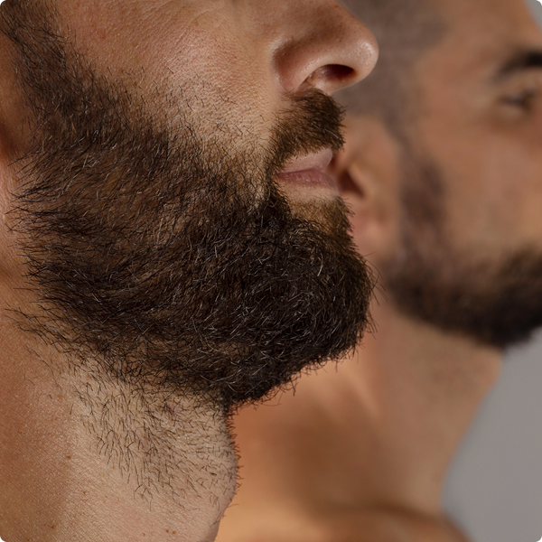 It Doesn’t Leave Your Beard Looking Like a Fryer Basket